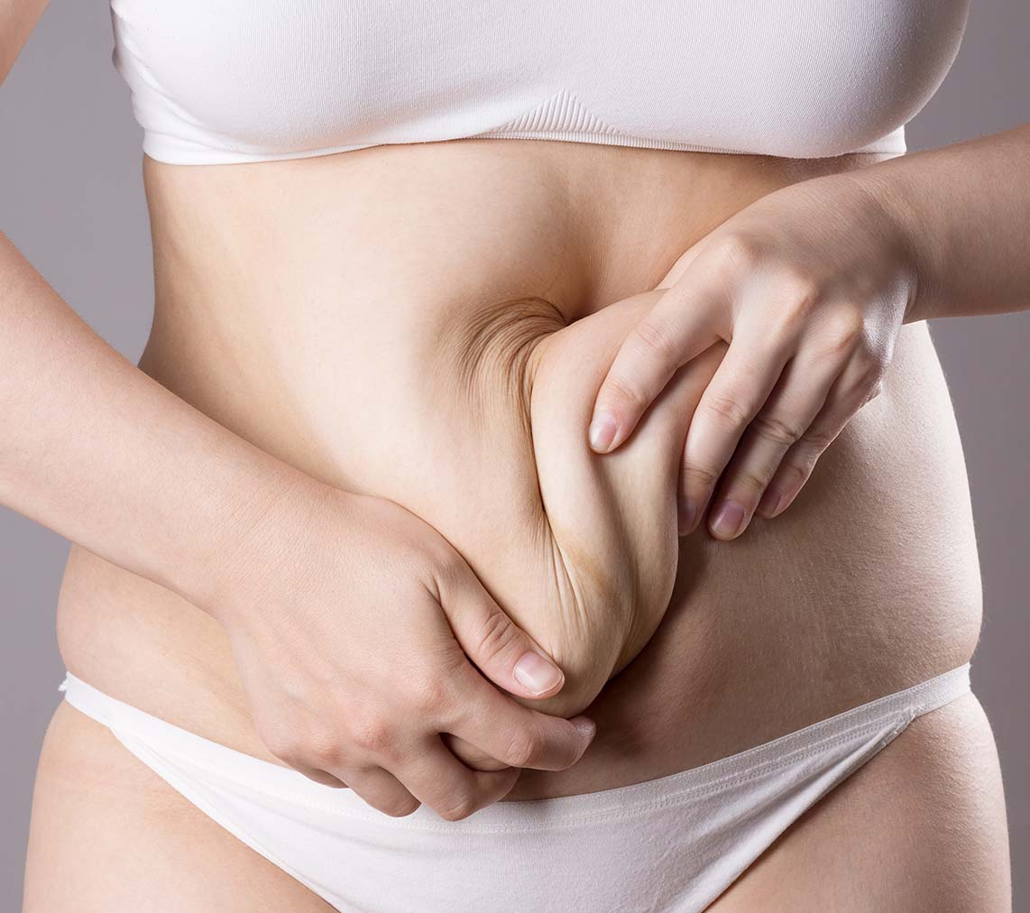 Estella Estetik | Tummy Tuck (Abdominoplasty) Why is it so preferred?