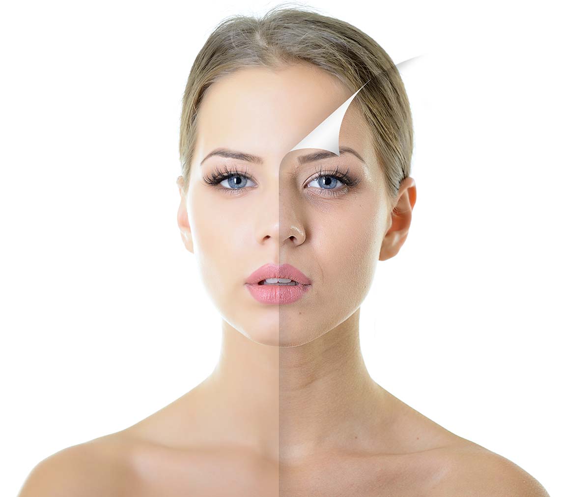 Estella Estetik | Collagen Face Lift