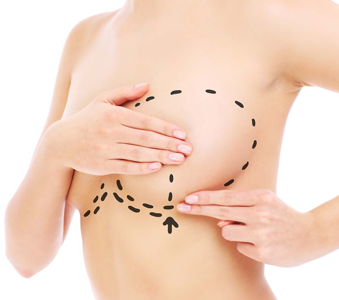 Estella Estetik | Breast Lift - Tightening Why is it so preferred?