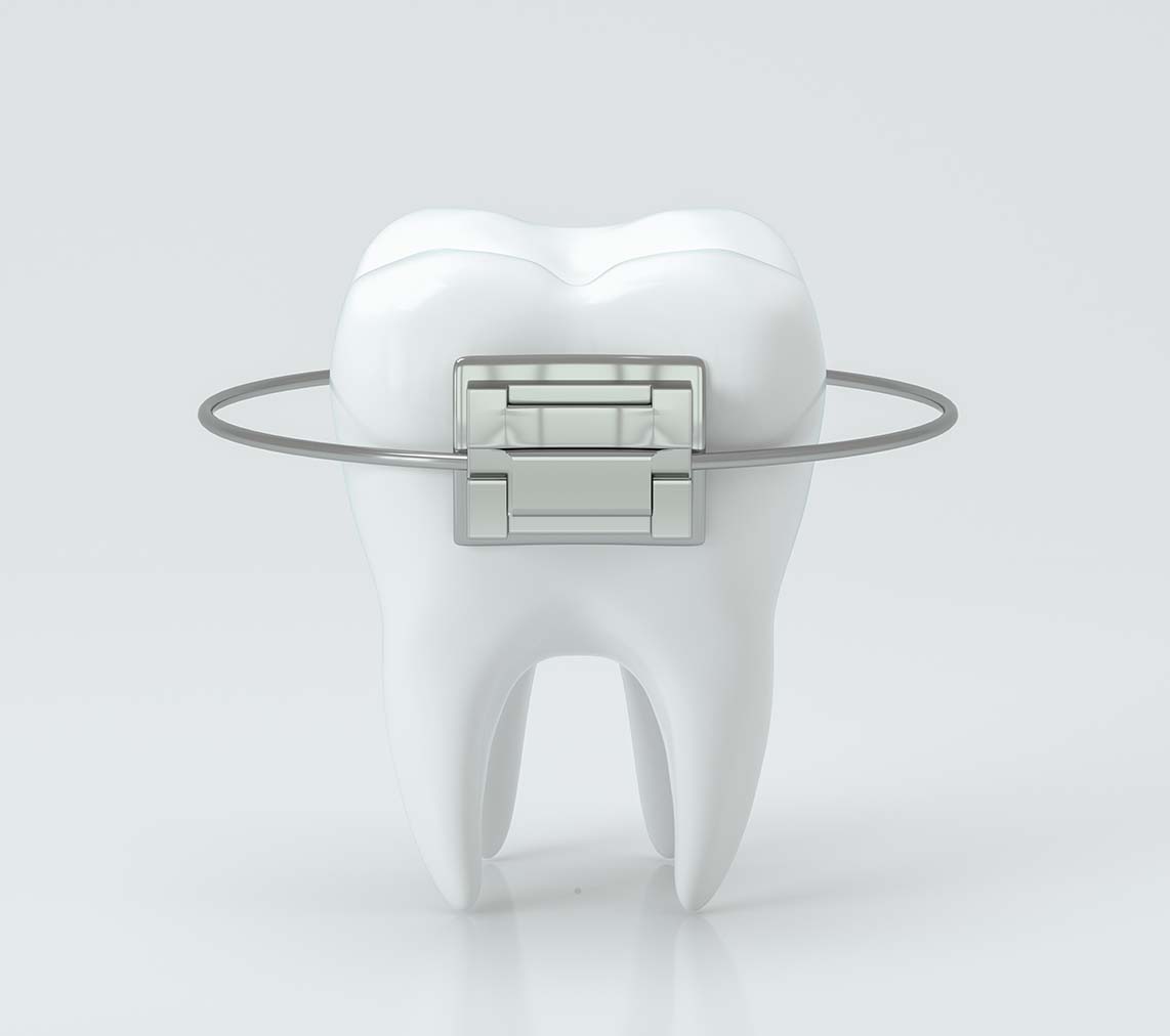 Estella Estetik | Orthodontics