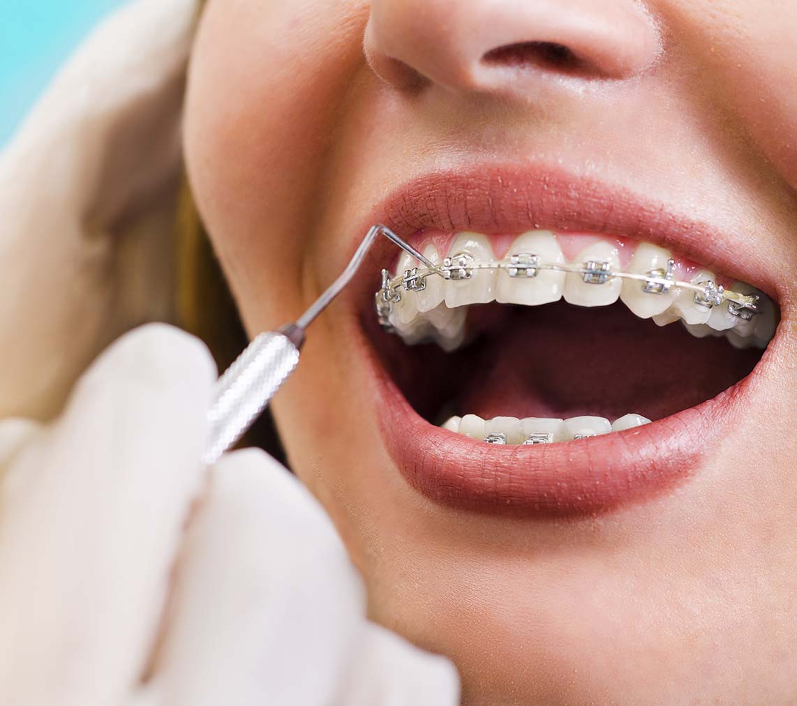Estella Estetik | Orthodontics Why is it so preferred?